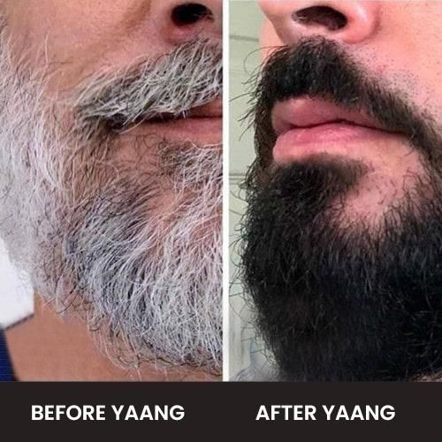 Anti Grey Beard Serum Oil - 100% Ayush Certified - For Premature Greying and Restore Natural Beard Color
