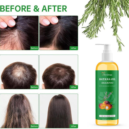 Batana Oil Shampoo for Hair Growth with Rosemary Extract🌱✨(Buy 1 Get 1 Free)