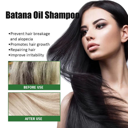 Batana Oil Shampoo for Hair Growth with Rosemary Extract🌱✨(Buy 1 Get 1 Free)